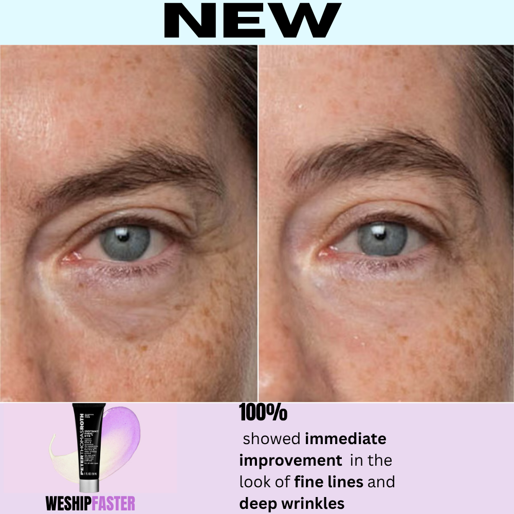 🌸Instant Eye Tightener No-Filter Primer - New Easy-Wear Formula,Ultimate Lift & Smooth✨